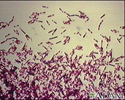 Clostridium difficile organism