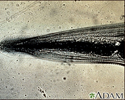 Pinworm - close-up of the head