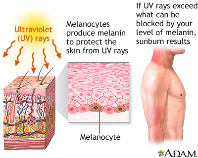 melanin sun protection