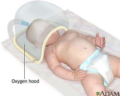 oxygen therapy baby