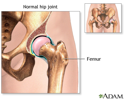 u području hip joint bol
