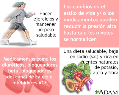 calina Desmantelar azufre Spanish HIE Multimedia - Presión arterial alta en adultos - hipertensión