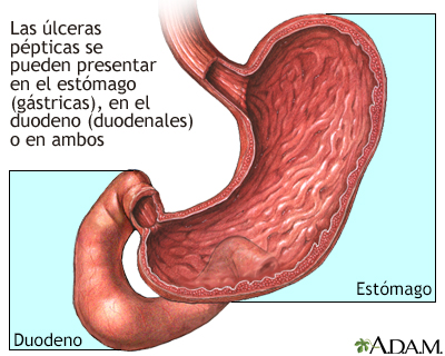 dureri articulare de ulcer stomacal)