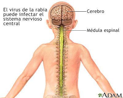 Spanish HIE Multimedia - Rabia